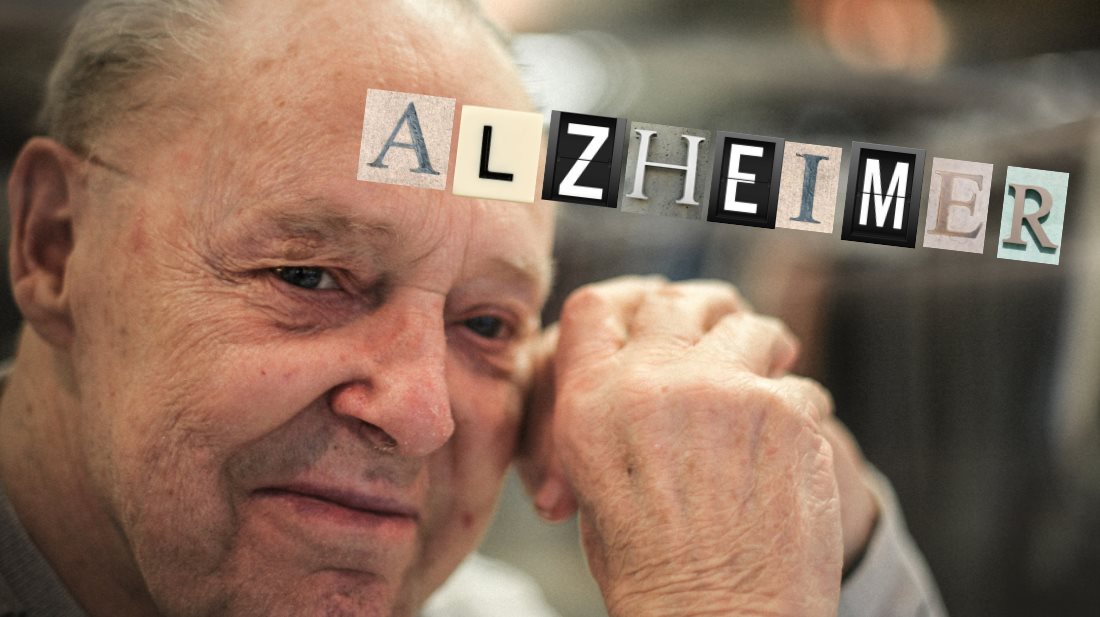 FASES ALZHEIMER