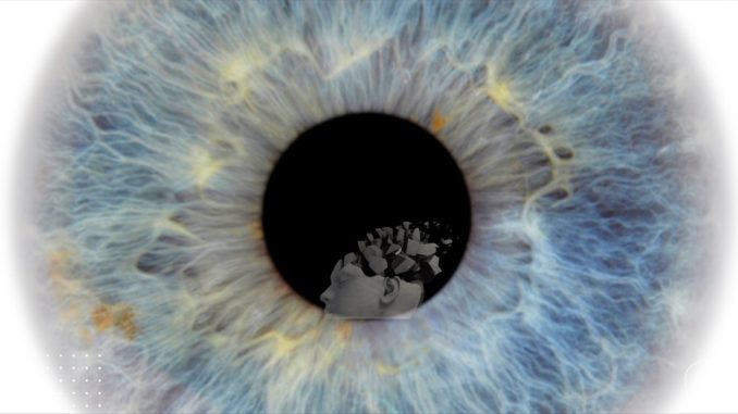 ojo alzheimer ojo alzheimer